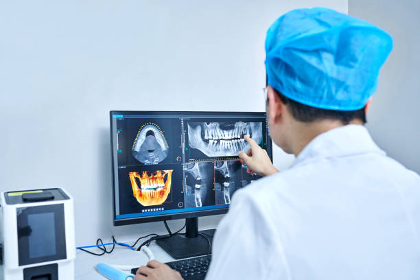 Best Emergency Root Canal Treatment in Kincheloe, MI